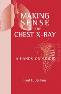 Making Sense of the Chest X-Ray: A Hands-On Guide