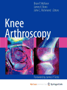 Knee Arthroscopy