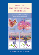 Ovarian Hyperstimulation Syndrome: Epidemiology, Pathophysiology, Prevention and Management
