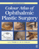 Colour Atlas of Ophthalmic Plastic Surgery
