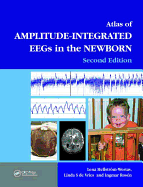 Atlas of Amplitude-Integrated EEGS in the Newborn