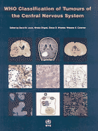 Who Classification of Tumours of the Central Nervous System