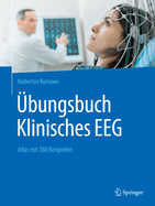 bungsbuch Klinisches EEG: Atlas mit 280 Beispielen