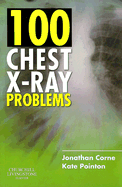 100 Chest X-Ray Problems - Corne, Jonathan, and Pointon, Kate, MRCP