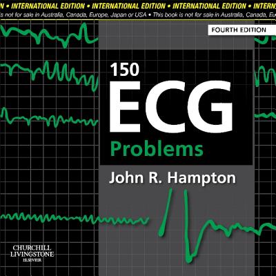 150 ECG Problems - Hampton, John R, DM, Ma, Dphil, Frcp