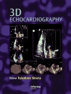 3D Echocardiography - Shiota, Takahiro, MD (Editor)