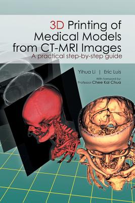 3D Printing of Medical Models from CT-MRI Images: A Practical step-by-step guide - Li Yihua, and Eric Luis