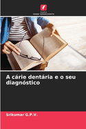 A crie dentria e o seu diagn?stico