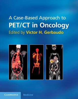 A Case-Based Approach to PET/CT in Oncology - Gerbaudo, Victor H. (Editor)