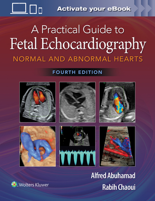 A Practical Guide to Fetal Echocardiography: Normal and Abnormal Hearts - Abuhamad, Alfred Z., and Chaoui, Rabih