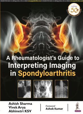 A Rheumatologist's Guide to Interpreting Imaging in Spondyloarthritis - Sharma, Ashish, and Arya, Vivek, and KSV, Abhinetri