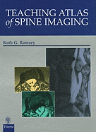 A Teaching Atlas of Spine Imaging