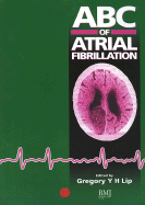 ABC of Atrial Fibrillation