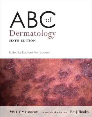 ABC of Dermatology - Morris-Jones, Rachael (Editor)