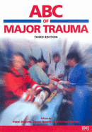 ABC of Major Trauma - Driscoll, Peter a (Editor), and Skinner, David V (Editor), and Earlam, Richard (Editor)