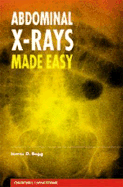 Abdominal X-Rays Made Easy - Begg, James D