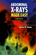 Abdominal X-Rays Made Easy - Begg, James D