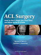 ACL Surgery: How to Get It Right the First Time and What to Do If It Fails