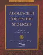 Adolescent Idiopathic Scoliosis