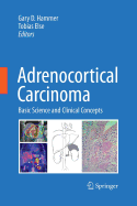 Adrenocortical Carcinoma: Basic Science and Clinical Concepts