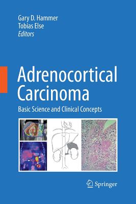 Adrenocortical Carcinoma: Basic Science and Clinical Concepts - Hammer, Gary D (Editor), and Else, Tobias (Editor)