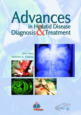 Advances in Hydatid Disease Diagnosis & Treatment - Filippou, Dimitrios (Editor)