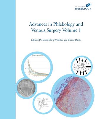 Advances in Phlebology and Venous Surgery - Volume 1 - Whiteley, Mark S. (Editor), and Dabbs, Emma B. (Editor)