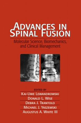 Advances in Spinal Fusion: Molecular Science, Biomechanics, and Clinical Management - Lewandrowski, Kai-Uwe