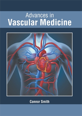 Advances in Vascular Medicine - Smith, Connor (Editor)