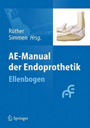 Ae-Manual Der Endoprothetik: Ellenbogen - R?ther, Wolfgang (Editor), and Simmen, Beat R (Editor)