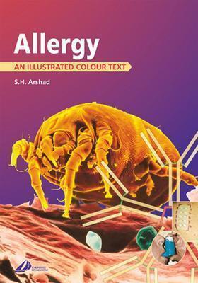 Allergy: An Illustrated Colour Text - Arshad, S H