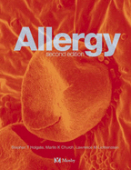 Allergy - Martinez, Fernando D, MD, and Church, Martin K, and Holgate, Stephen T, MD, Dsc, Frcp, Frcpe, Mrc