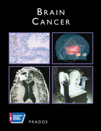 American Cancer Society Atlas of Clinical Oncology: Brain Cancer (Book with CD-ROM)