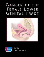 American Cancer Society Atlas of Clinical Oncology: Cancer of the Female Lower Genital Tract (Book with CD-ROM)