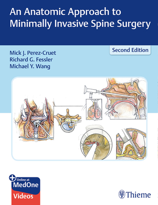 An Anatomic Approach to Minimally Invasive Spine Surgery - Perez-Cruet, Miguelangelo (Editor), and Fessler, Richard G (Editor), and Wang, Michael y (Editor)