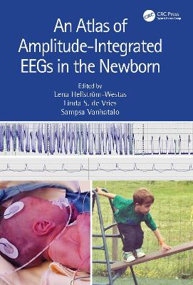 An Atlas of Amplitude-Integrated Eegs in the Newborn - de Vries, Linda S (Editor), and Hellstrm-Westas, Lena (Editor), and Vanhatalo, Sampsa (Editor)