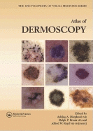 An Atlas of Dermoscopy