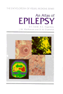 An Atlas of Epilepsy
