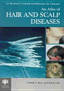 An Atlas of Hair and Scalp Diseases