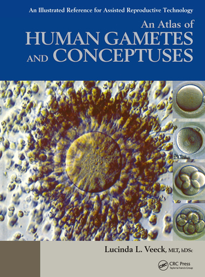 An Atlas of Human Gametes and Conceptuses: An Illustrated Reference for Assisted Reproductive Technology - Veeck, Lucinda L (Editor)