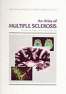 An Atlas of Multiple Sclerosis