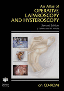 An Atlas of Operative Laparoscopy and Hysteroscopy, Second Edition on CD-ROM D Basic Research