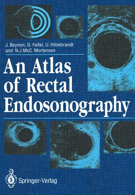 An Atlas of Rectal Endosonography - Beynon, John, and Feifel, Gernot, and Hildebrandt, Ulrich