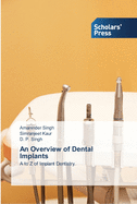 An Overview of Dental Implants