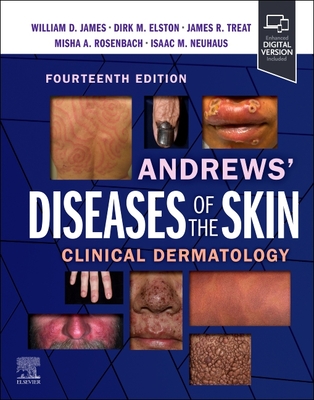 Andrews' Diseases of the Skin: Clinical Dermatology - James, William D, MD, and Elston, Dirk M, MD, and Treat, James R, MD