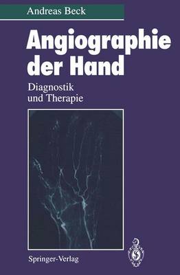 Angiographie Der Hand: Diagnostik Und Therapie - Beck, Andreas