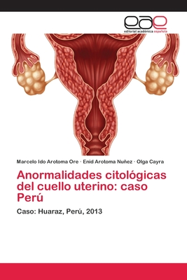 Anormalidades citolgicas del cuello uterino: caso Per - Arotoma Ore, Marcelo Ido, and Arotoma Nuez, Enid, and Cayra, Olga