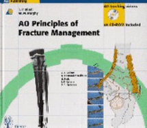 Ao Principles of Fracture Management