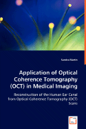 Application of Optical Coherence Tomography (OCT) in Medical Imaging - Martin, Sandra