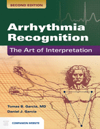 Arrhythmia Recognition: The Art of Interpretation: The Art of Interpretation